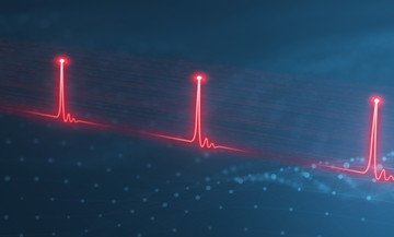 Short Laser Pulses
